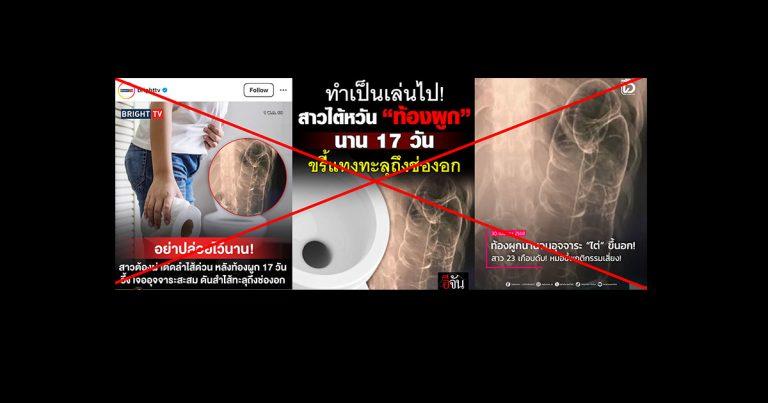ตรวจสอบแล้ว : ข่าวอ้างท้องผูกนานจนอุจจาระดันทะลุหัวใจ แพทย์ยืนยันแล้ว อุจจาระในลำไส้ไม่สามารถแทงขึ้นไปบนช่องอกได้